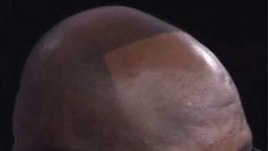 shaq hairstyle