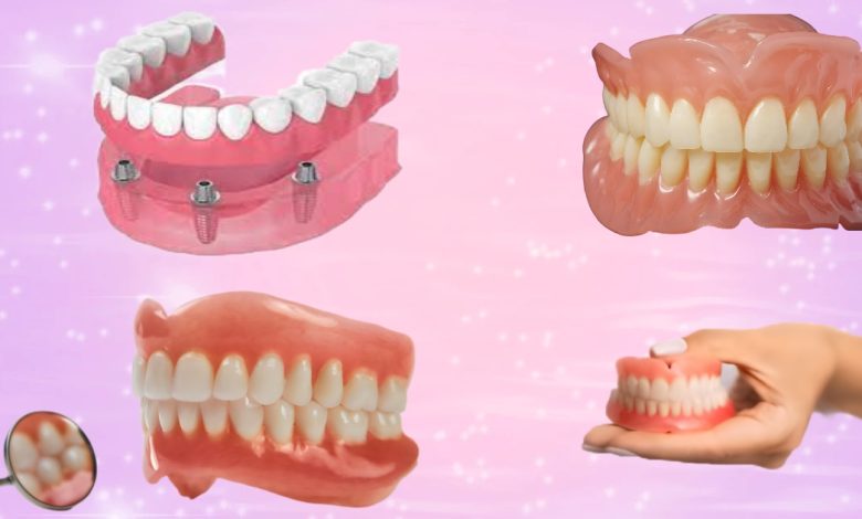 Complete Dentures