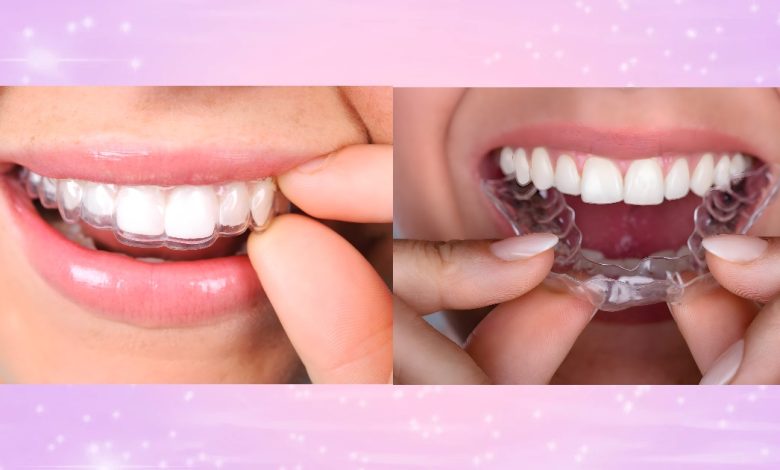 Invisalign for Adults