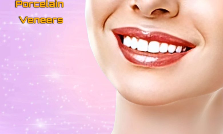 Porcelain Veneers