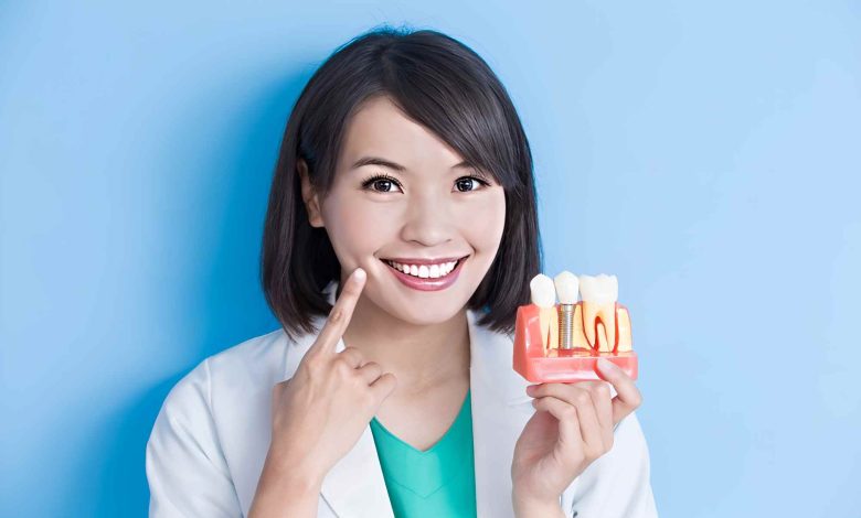 affordable teeth implants