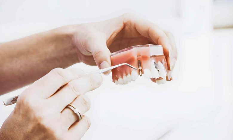 how much is a dental implant