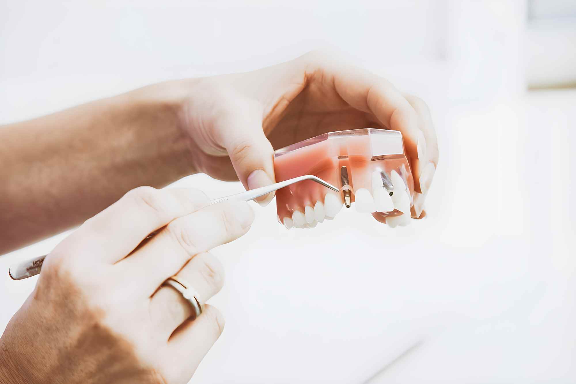 how much is a dental implant